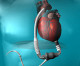 Thoratec Announces Start Of Heartmate III™ U.S. Clinical Trial