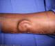 Surgeons grow soldier’s new ear in her FOREARM after she suffered devastating head injuries in a horror car accident Surgeons grow soldier’s new ear in her FOREARM after she suffered devastating head injuries in a horror car accident